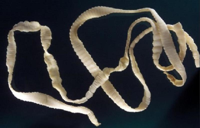 الدودة الشريطية