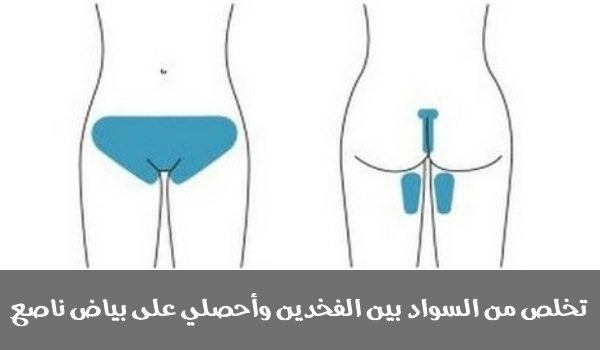 طرق ازالة سواد الفخذين