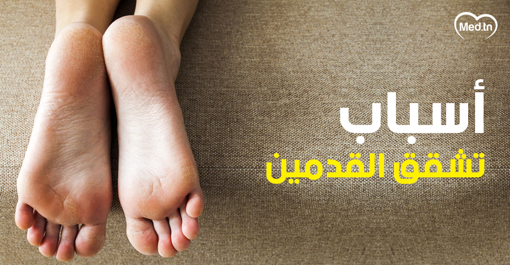 اسباب تشقق القدمين