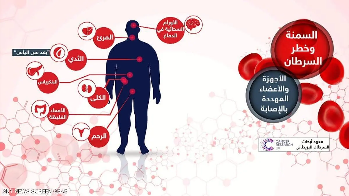علاقة السمنة بالسرطان