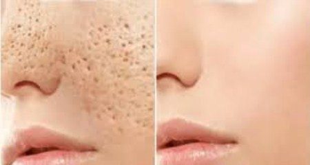 طرق تفتيح المسامات وتنقية البشرة